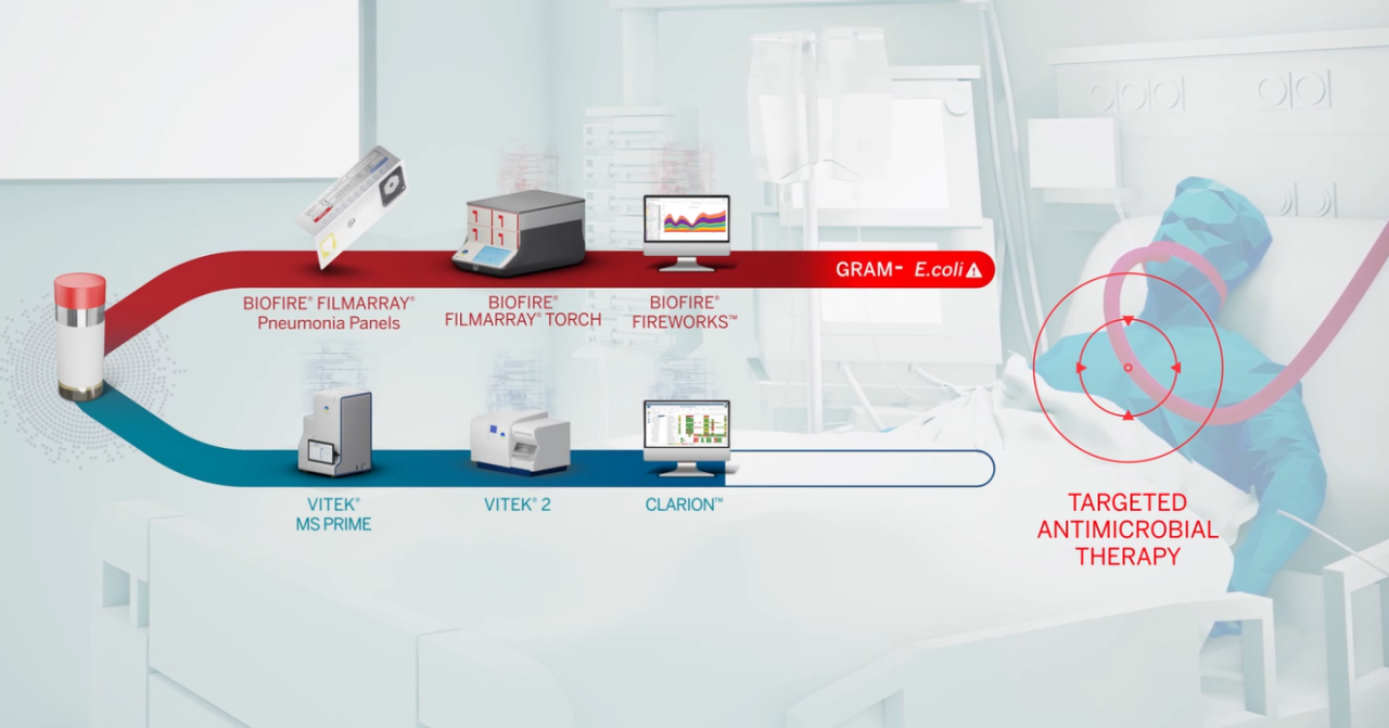 COVID-19 Respiratory Co-Infections